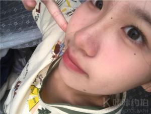 鱼蛋