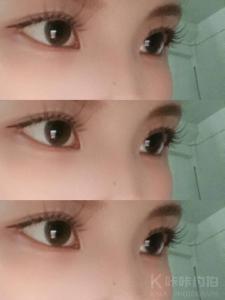 接**