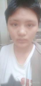 张雅淇